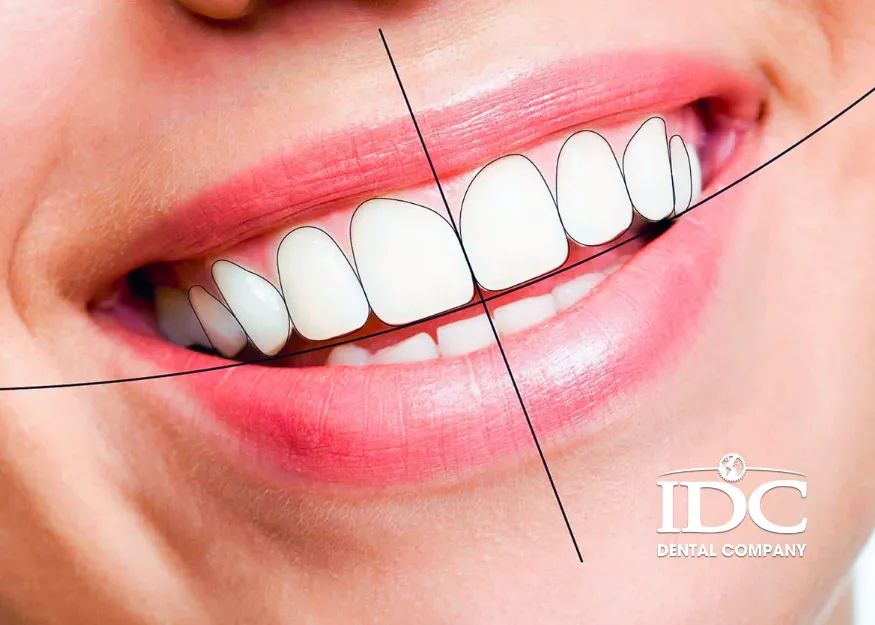 Digital Smile Design Service in Da Nang City