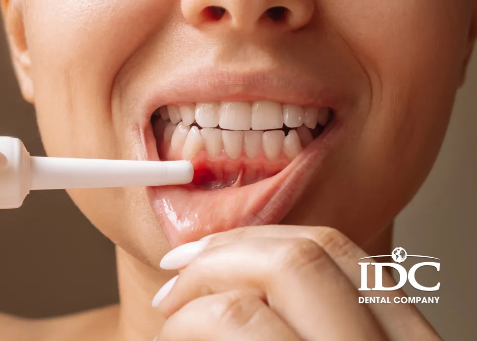 Does Periodontal Treatment Hurt?