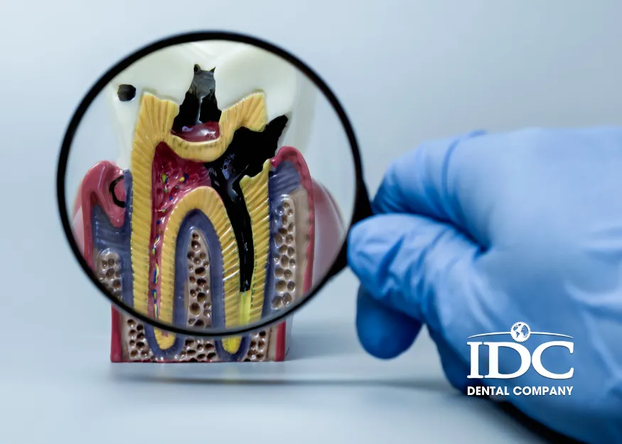 Does root canal treatment hurt during the procedure?