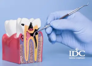 Signs of periodontal disease