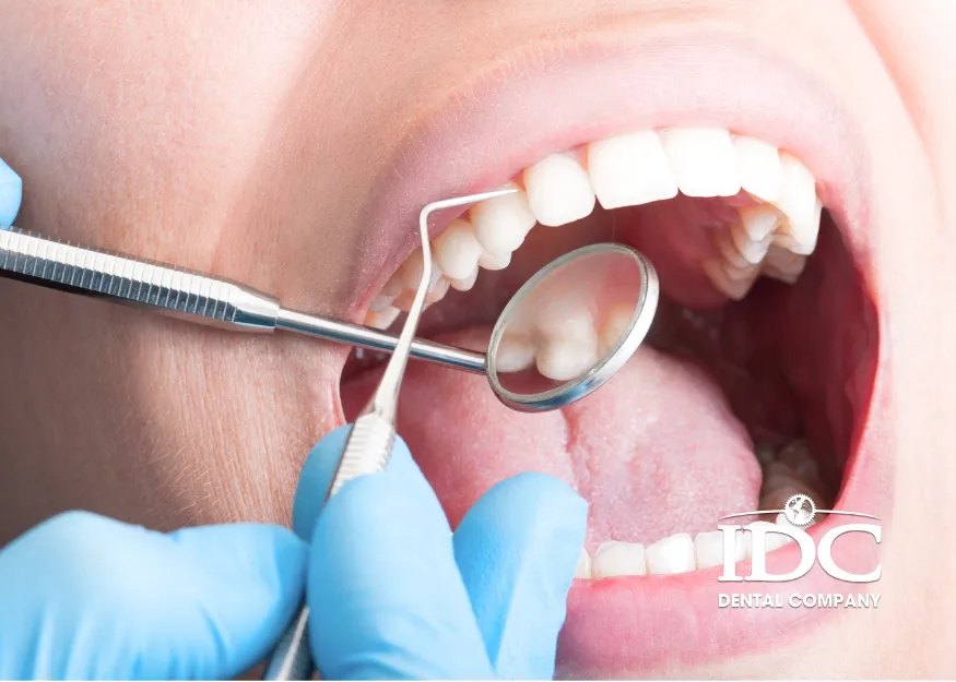 Why is teeth cleaning important?