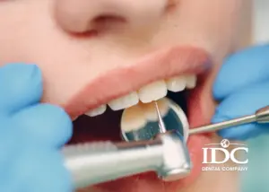 Teeth Cleaning in Da Nang City