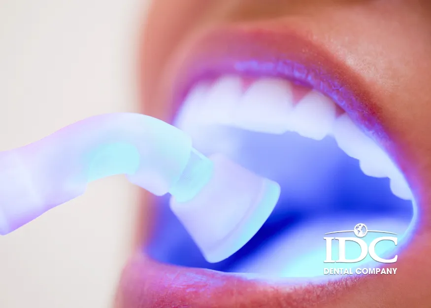 Tooth Fillings for Expats and Tourists in Da Nang