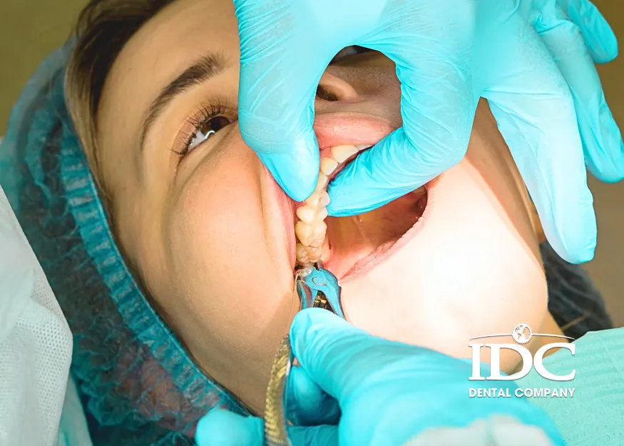 Tooth extraction in Da Nang City, Vietnam