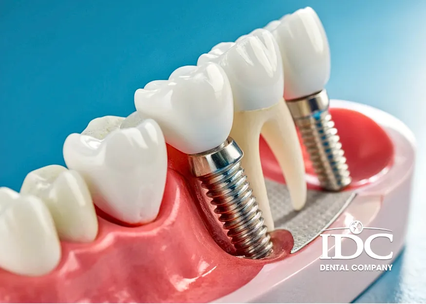 What Can You Eat After Dental Implant Surgery?