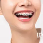 an uong khi nieng rang nhu the nao cho dung 1