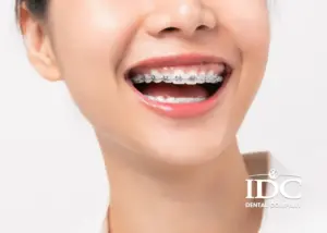 an uong khi nieng rang nhu the nao cho dung 1