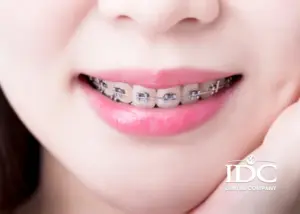 bao nhieu tuoi nieng rang tot nhat