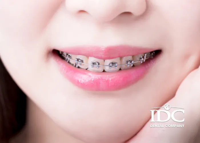 bao nhieu tuoi nieng rang tot nhat