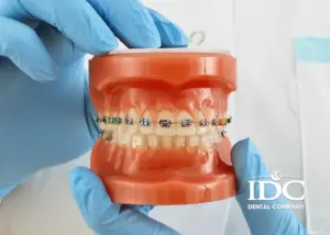 cac giai doan nieng rang dien ra nhu the nao