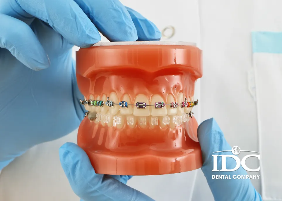 Các giai đoạn niềng răng diễn ra như thế nào?