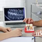 Nha Khoa Trồng Răng Tại Đà Nẵng