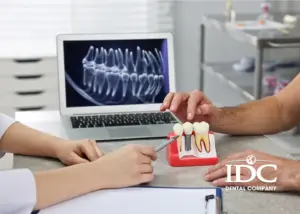 Các Quy Trình Niềng Răng Chuẩn Tại Nha Khoa IDC