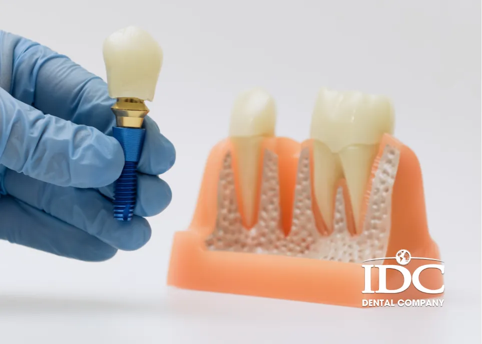 Răng Implant có niềng được không?