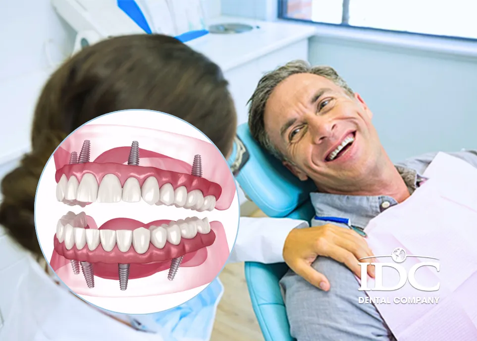 How much does a full mouth dental implant cost in Da Nang City