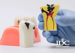 What Are the Signs of an Infected Tooth