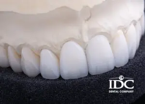 Where can I get same day dental crowns in Da Nang City 1