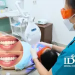 Where to get teeth whitening near Da Nang City