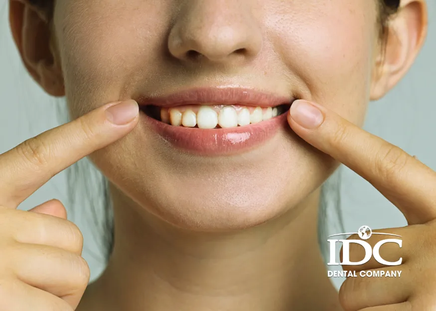 Why You Should Fix a Chipped Tooth Early