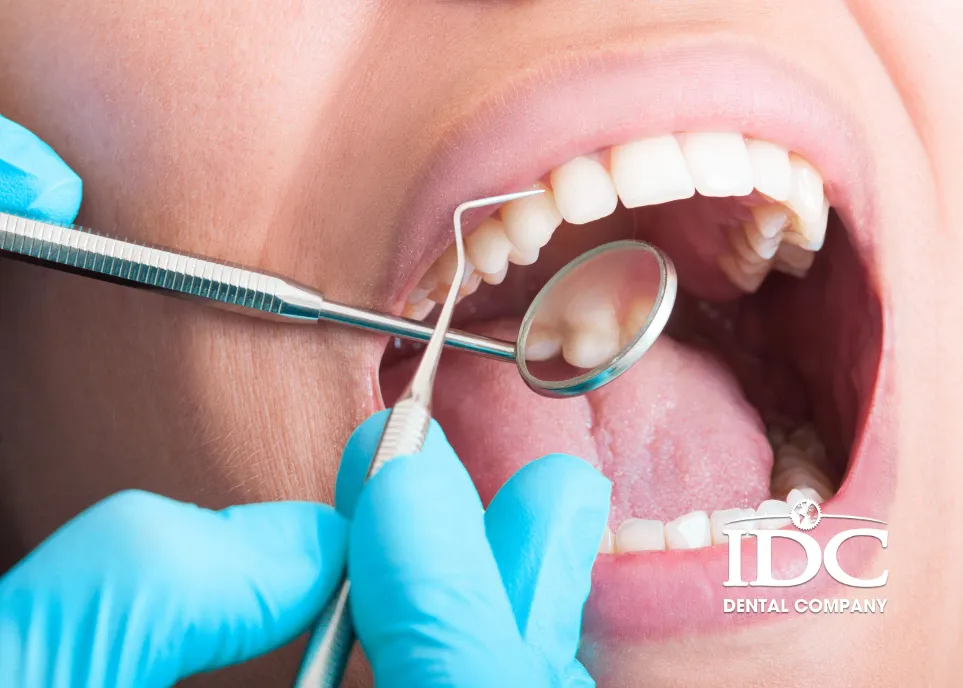 Benefits of Teeth Cleaning Every 6 Months