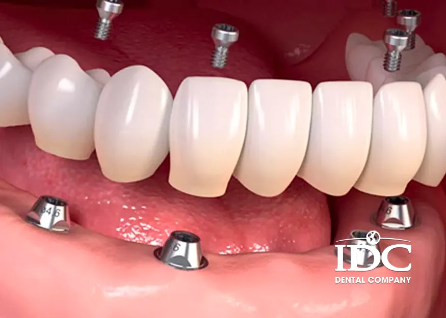 Where can I do a full-mouth dental makeover in Da Nang City?