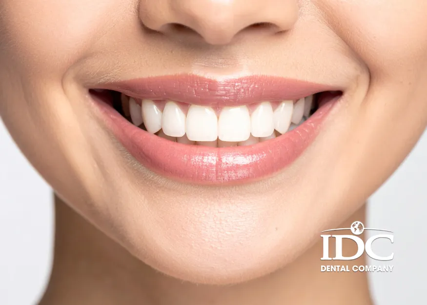 Why Choose IDC Da Nang Dental for a Full-Mouth Dental Makeover?