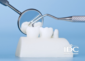 Kỹ Thuật Trồng Răng Implant Tại Nha Khoa IDC
