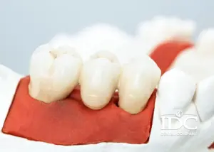 What is Dental Tourism and its benefits?