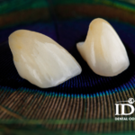 boc rang su bi sau co that khong