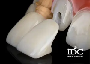 boc rang su gia re 2