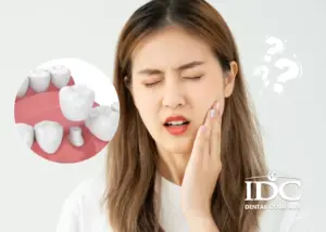 Răng sứ Lava có bền không? Tuổi thọ thực tế bao lâu?