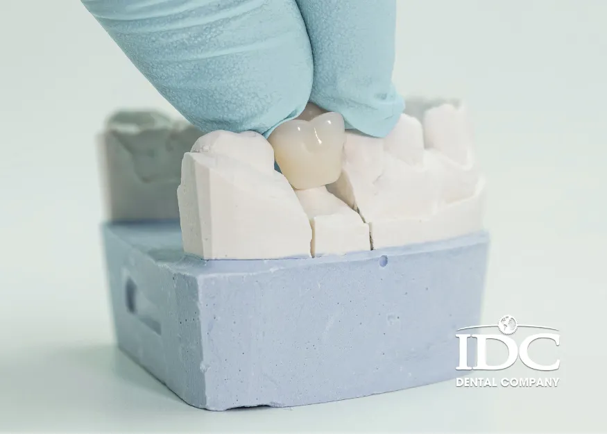 Răng sứ Titan có tốt không?