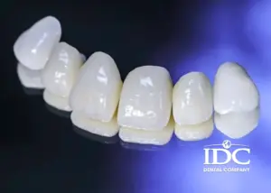 Làm răng sứ bị ê buốt nguyên nhân do đâu ? Cách nhận biết và khắc phụ hiệu quả