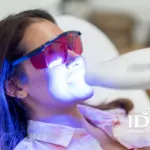 Best Teeth Whitening in Da Nang City for a Brighter Smile