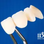 How Much Does a Dental Crown Cost in Da Nang City