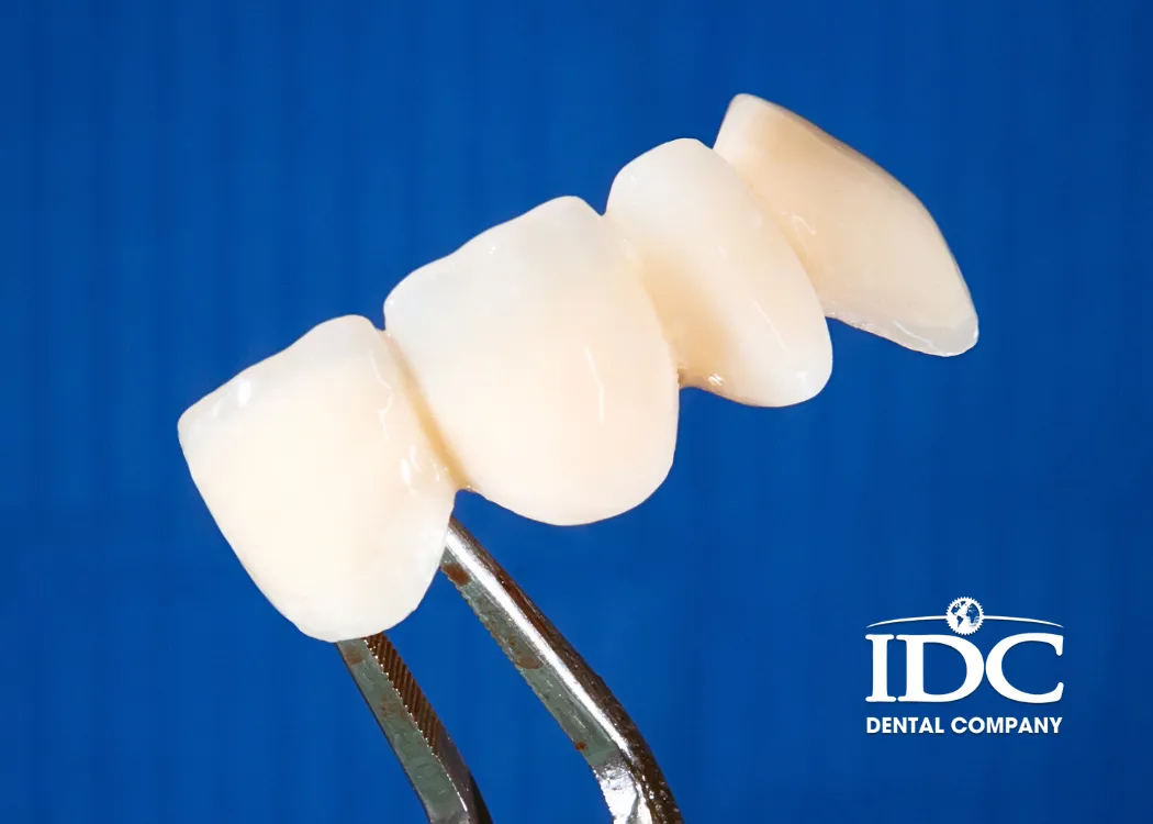 How Much Does a Dental Crown Cost in Da Nang City