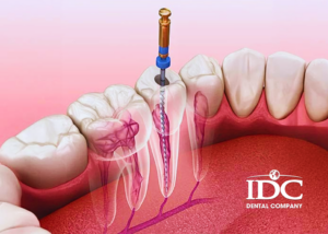 Where can I get same-day dental crowns in Da Nang City?