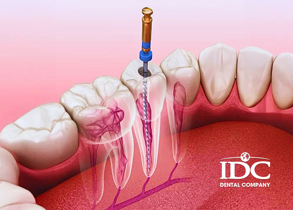 Pain Free Root Canal Treatment