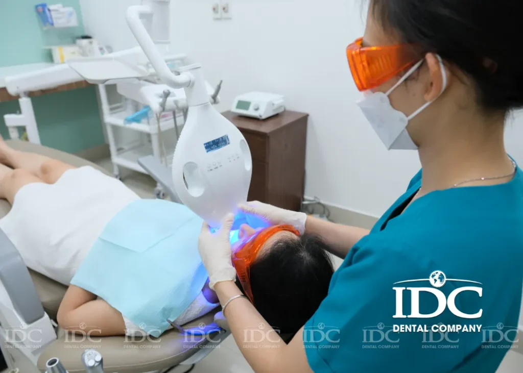Teeth Whitening at IDC Da Nang Dental