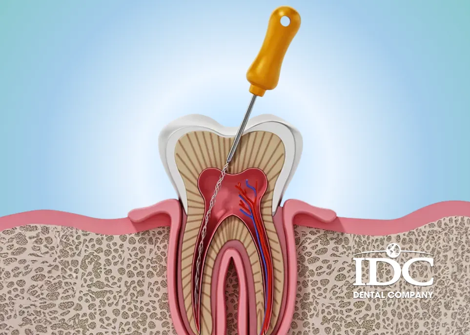How to Choose the Best Dental Clinics for Root Canal Treatment in Da Nang