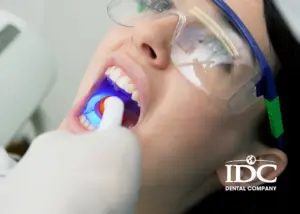 The Best Dental Clinics for Root Canal Treatment in Da Nang City, Vietnam