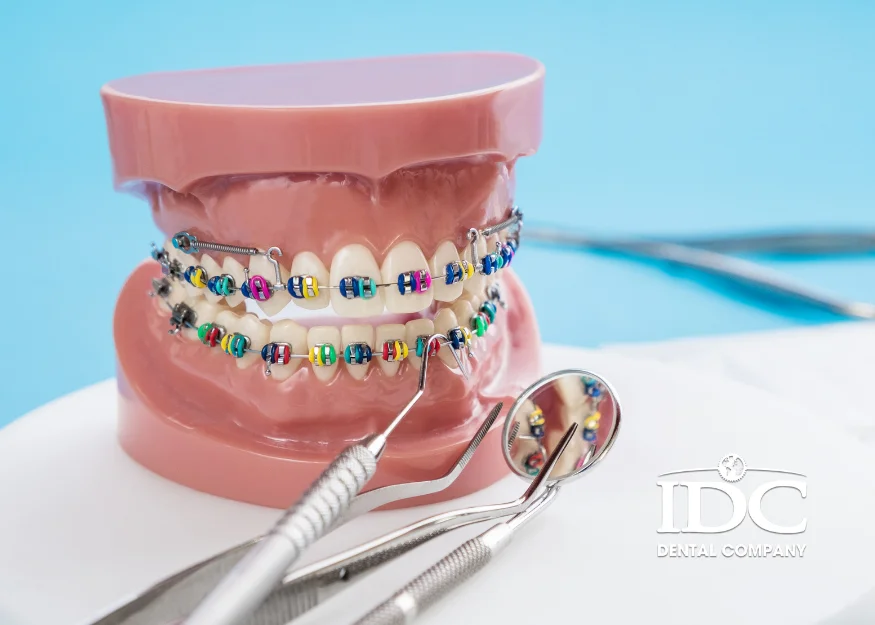 Top 5 reputable orthodontic dental addresses in Da Nang City