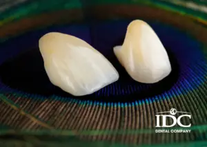 Trồng răng sứ cao cấp có gì khác so với răng sứ thường?