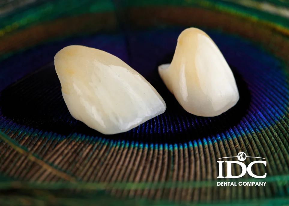 Bọc 1 răng sứ tại Đà Nẵng giá bao nhiêu?