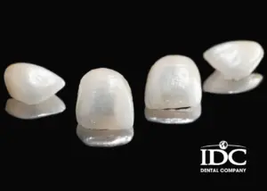 Trồng răng sứ cao cấp có gì khác so với răng sứ thường?