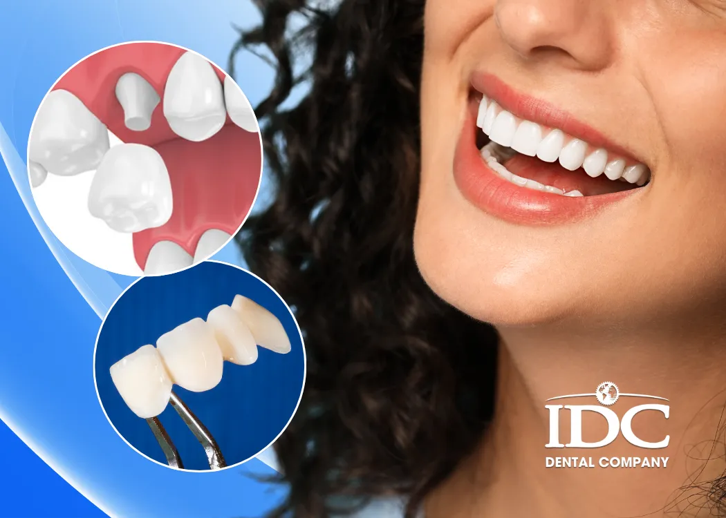 boc cau rang su la gi