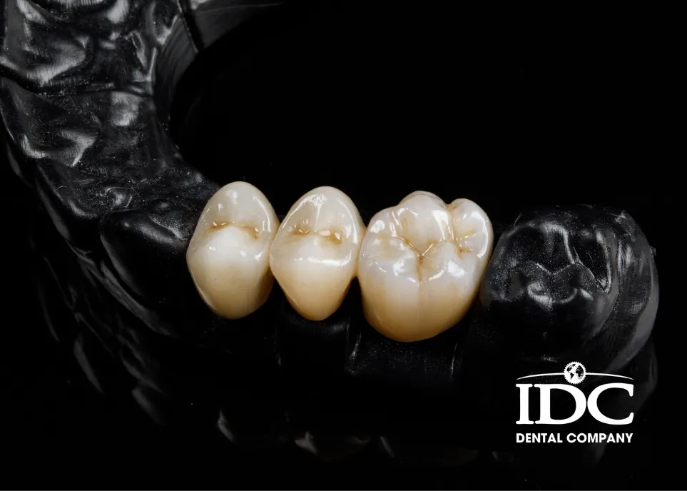 Bọc cầu răng sứ có tốt không?