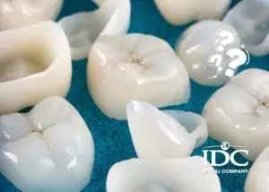 Vì sao bọc răng sứ bị đau nhức? 5 Nguyên nhân thường gặp