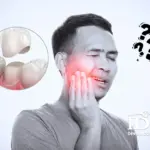 Sau khi bọc răng sứ bị ê buốt có bình thường?