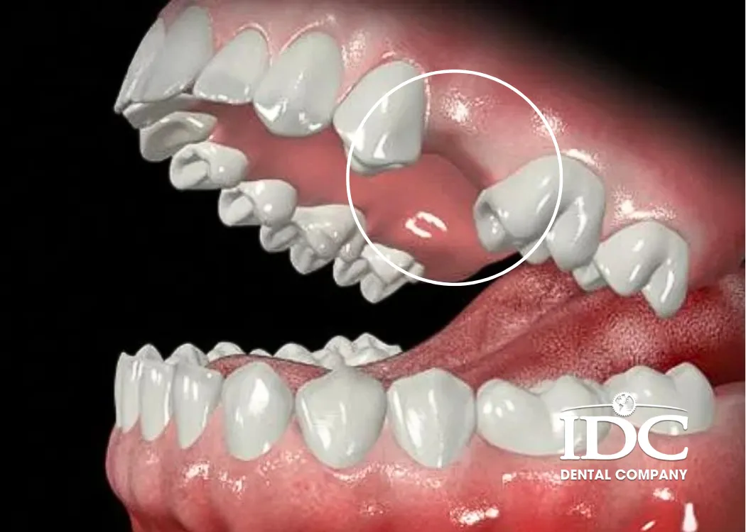 mat rang lau nam co trong duoc khong